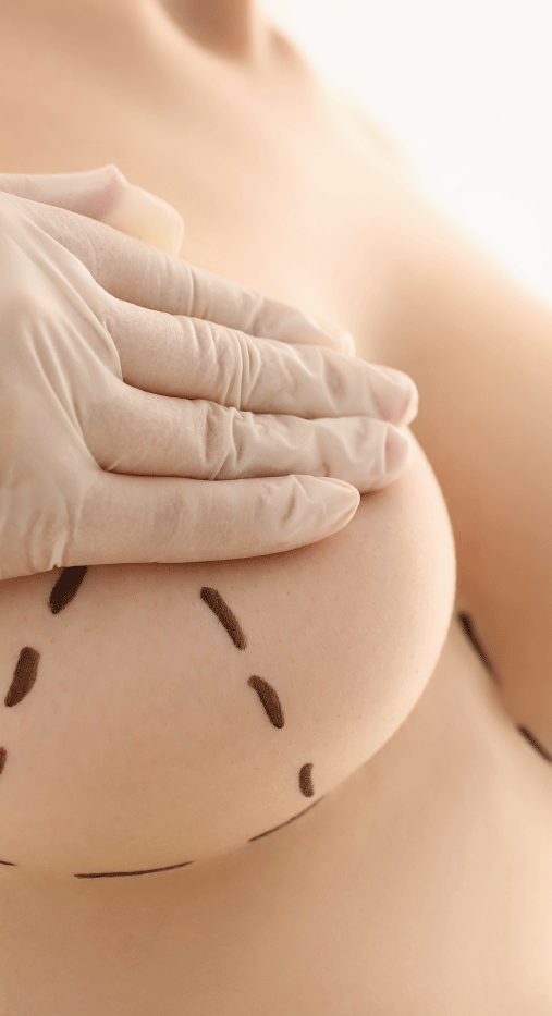 ¿De qué depende que una cicatriz quede mejor o peor?