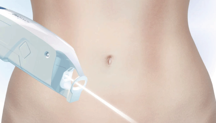 UrgoTouch: innovación láser para mejorar la cicatrización quirúrgica